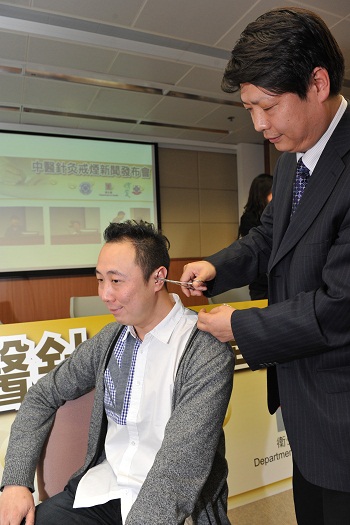 楊金生教授示範以中醫針灸方法為求助者戒煙。